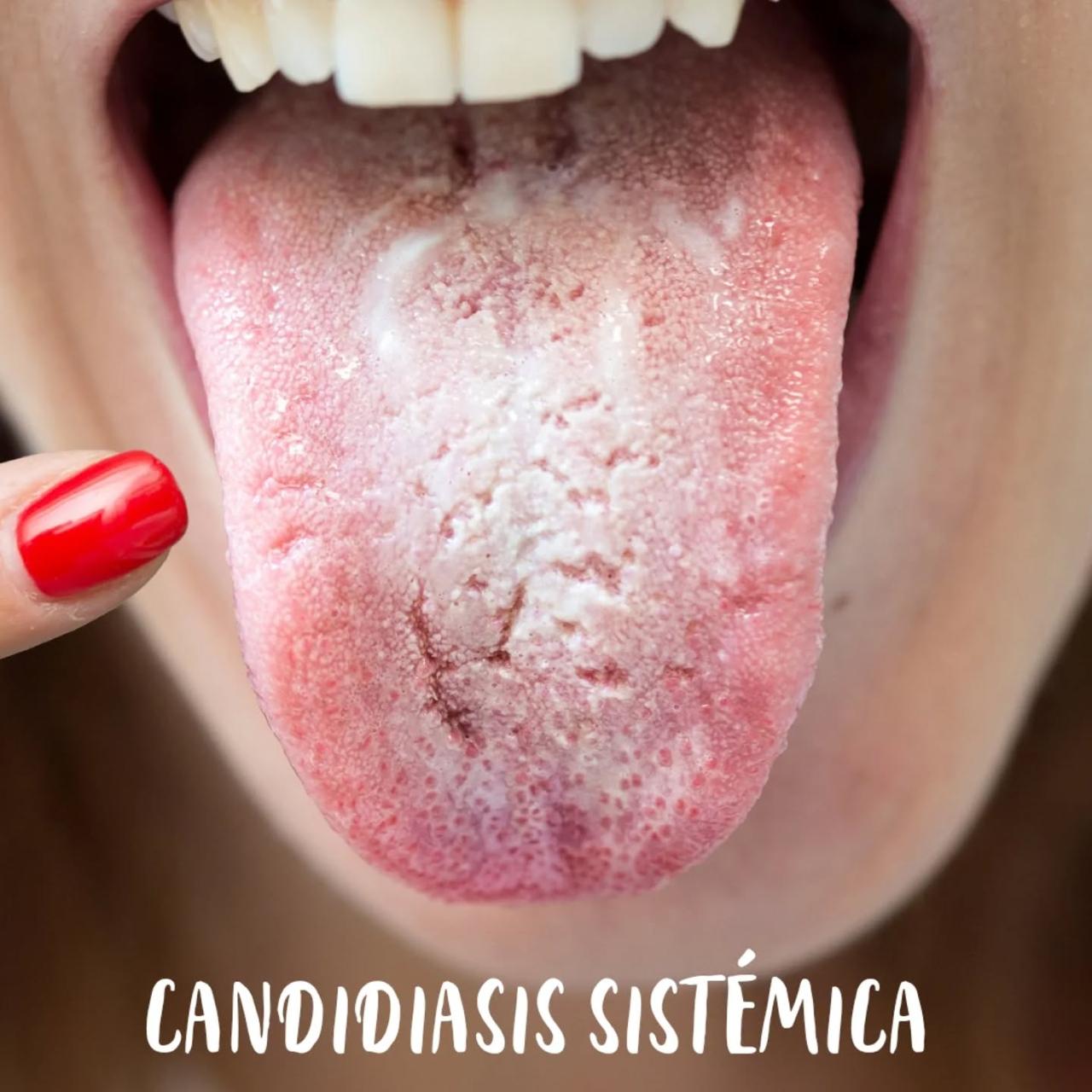 CANDIDA CLEANSE 60 ANTI-HONGOS 60 CAPSULAS
