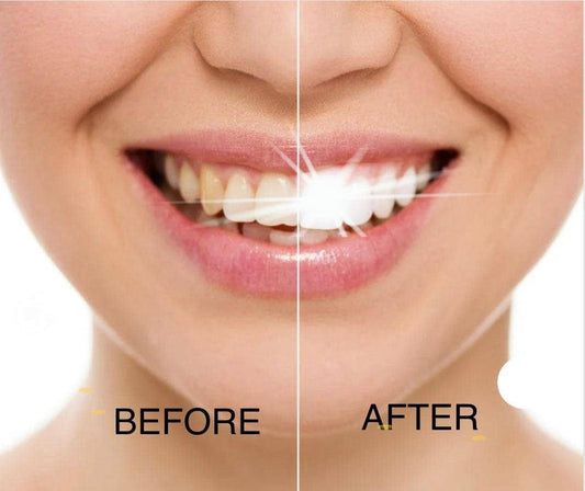 Blanqueador Dental Dazzling White 2x1