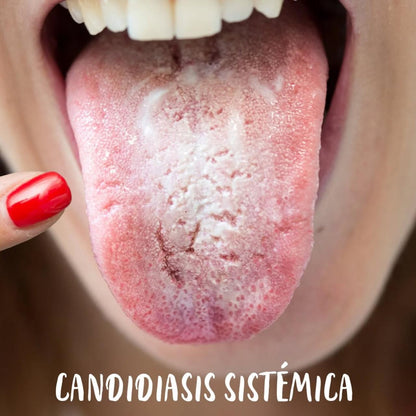 CANDIDA CLEANSE 60 ANTI-HONGOS 60 CAPSULAS